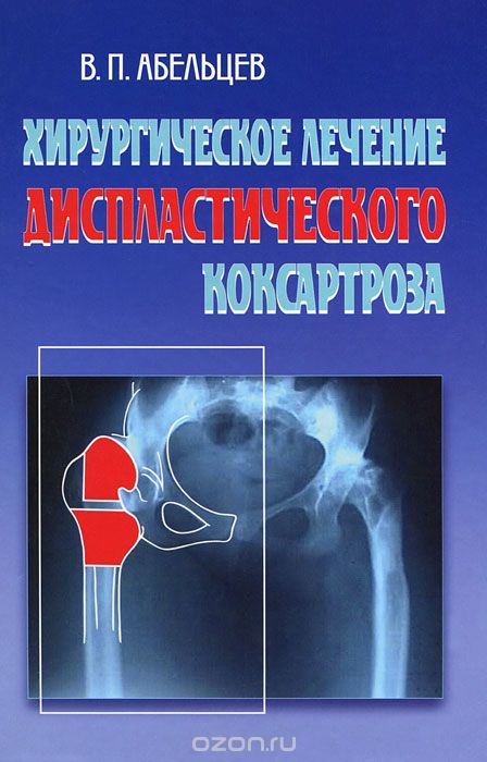 Скачать книгу "Хирургическое лечение диспластического коксартроза, В. П. Абельцев"