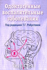 Скачать книгу "Одонтогенные воспалительные заболевания, Под редакцией Е. Г. Робустовой"