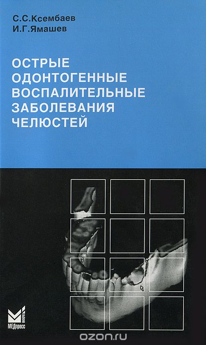 Скачать книгу "Острые одонтогенные воспалительные заболевания челюстей, С. С. Ксембаев, И. Г. Ямашев"